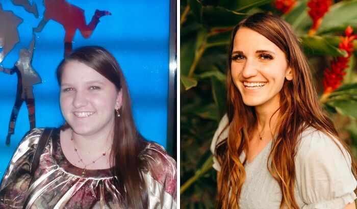 "Amazing What Growing Out Of Your Baby Fat Cheeks Can Do. 15-Year-Old vs. 30-Year-Old"