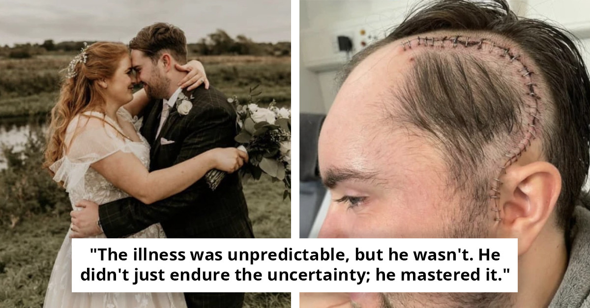 31-Year-Old Man Misdiagnosed with Terminal Illness Following Exercise-Related Symptom