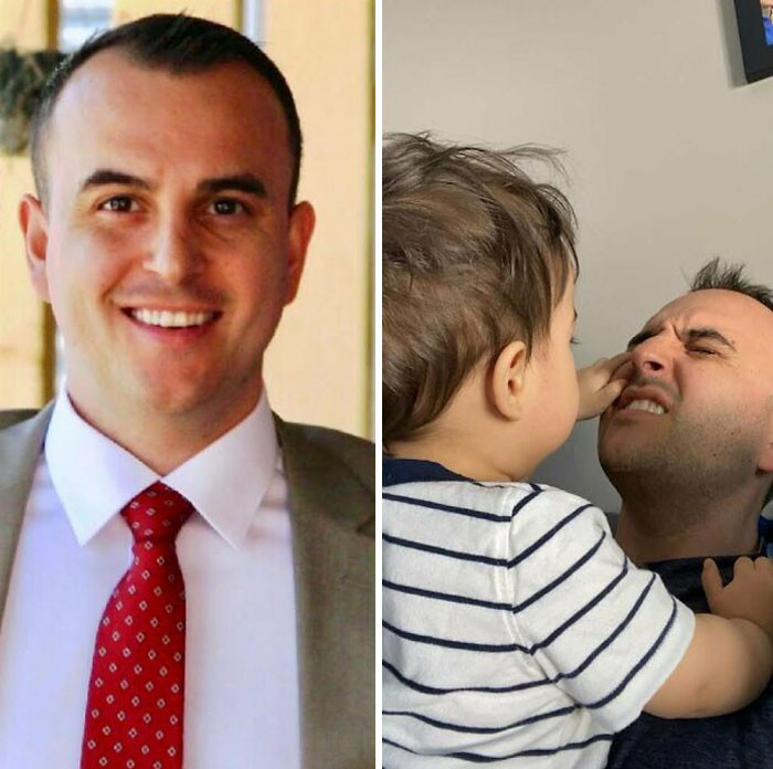 32. From Power Tie To Losing An Eye