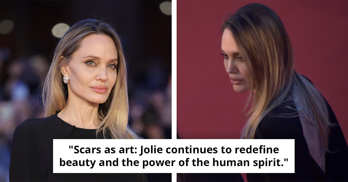Angelina Jolie Unveils Mastectomy Scars in a Groundbreaking Move