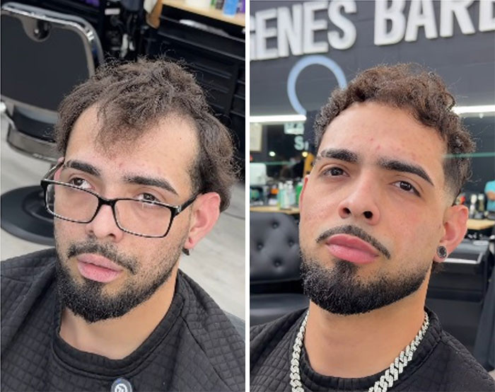 Before & After