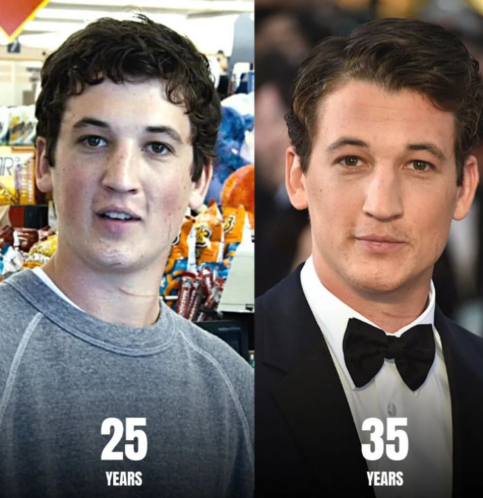 10. Miles Teller