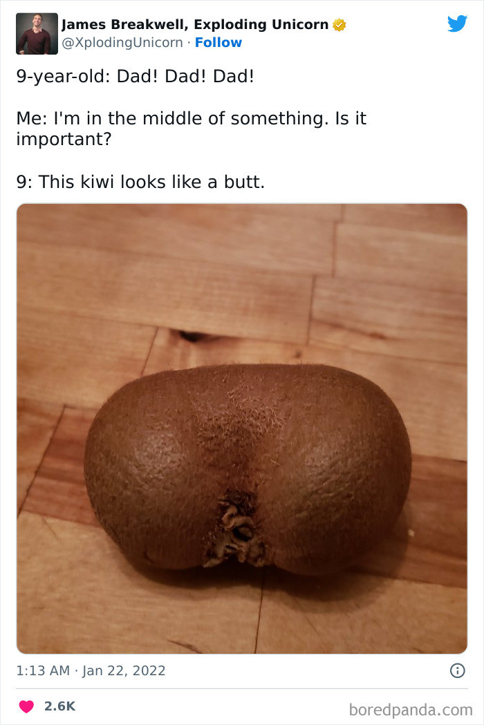 36. This kiwi does look like a butt