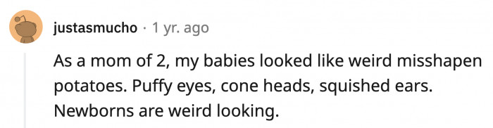 3. This mom was blessed with not just one, but two questionable-looking potatoes... I mean babies.