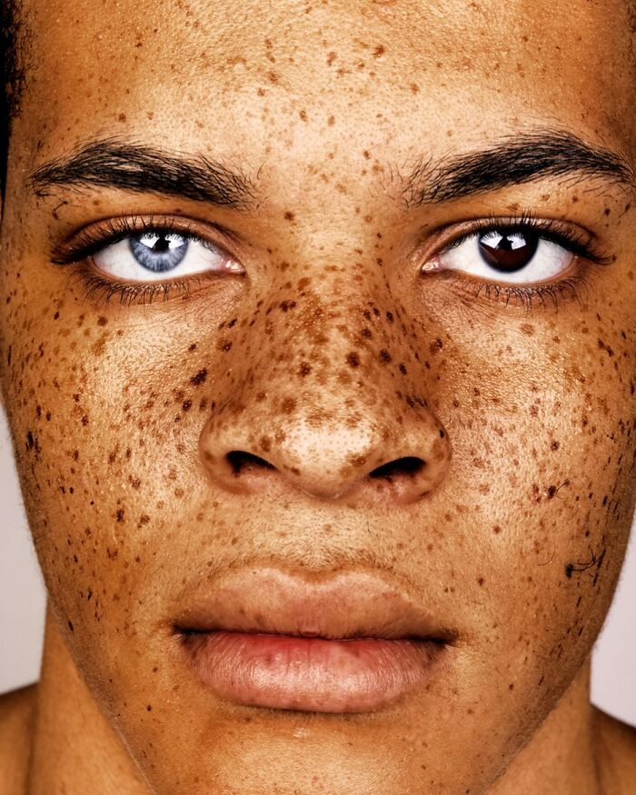 “Kaine Buffonge” - Freckles