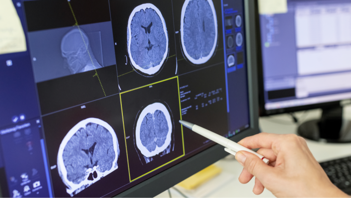 Medical professional assessing stroke warning signs, urgent headache and numbness symptoms
