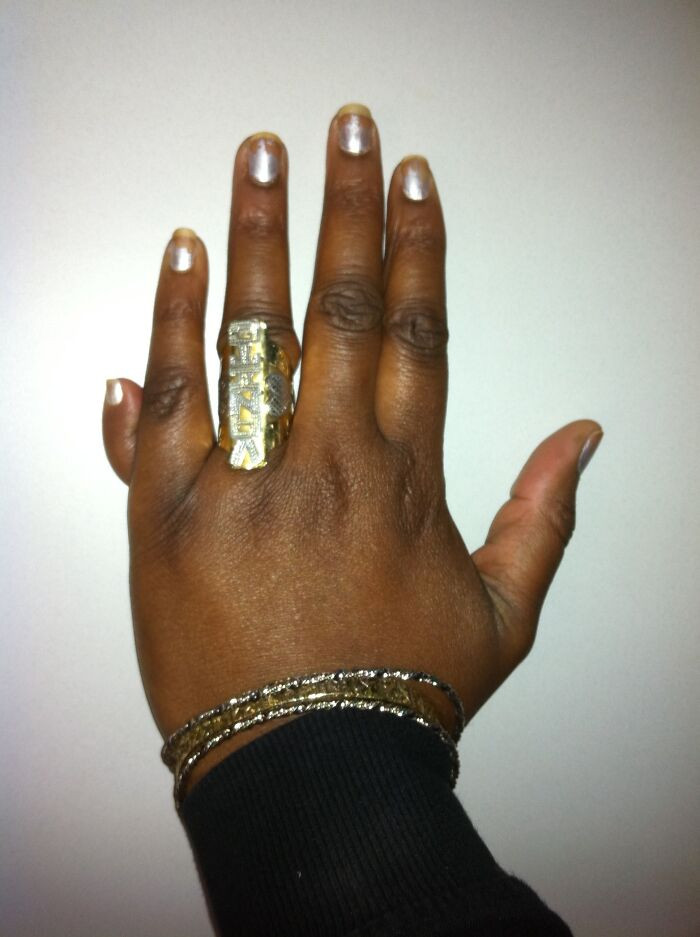 A 12-fingered person