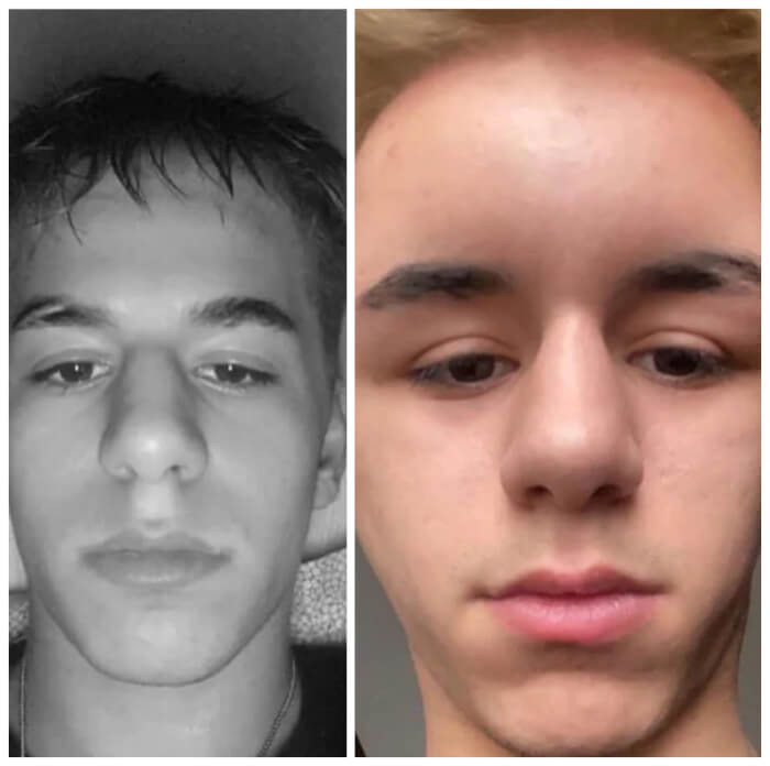 16. My friend dyed his hair; we found out that he is allergic.