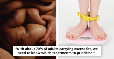 Most Americans May Now Be ‘Obese’ Without Gaining A Pound