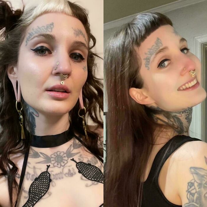 "My Ears Before And After Getting Them Reconstructed (Almost 3 Years Healed)"