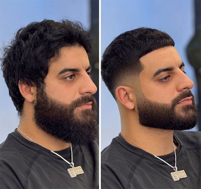 Before & After