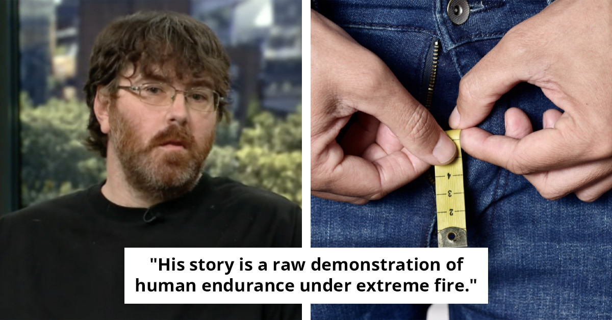 "Insight into Life of Man with 'Smallest Penis' Post Surgeons' Inability to Assist"