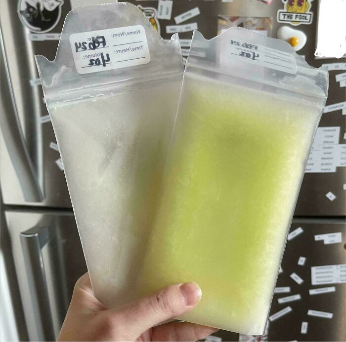"Frozen Breastmilk Before And After Consuming Large Amounts Of B12"