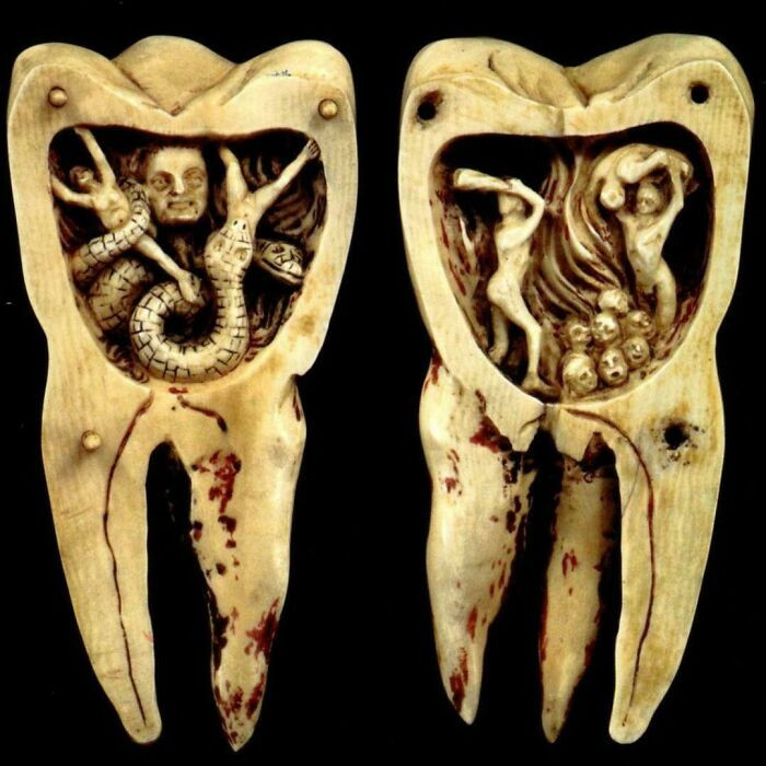 People once believed that toothaches and cavities were the work of tiny demons drilling holes straight into their teeth.