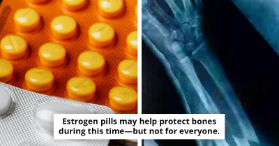 Some Birth Control Pills May Lower Risk Of Bone Disease