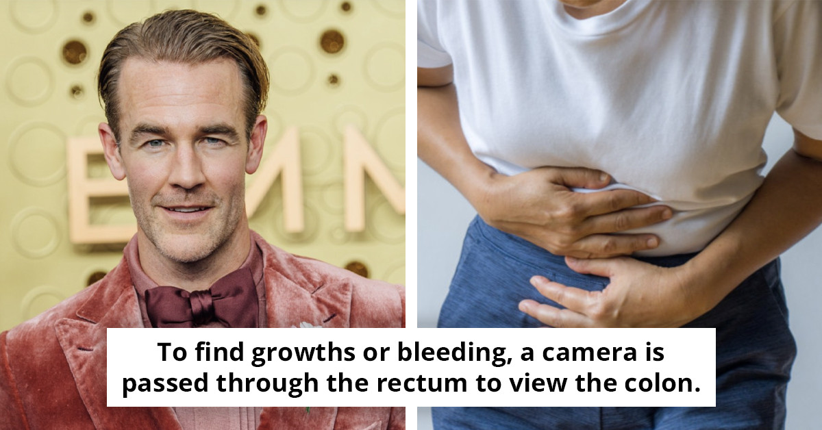 Colorectal Cancer Symptoms Highlighted as Dawson's Creek Actor James Van Der Beek Passes Away at 48 Due to Illness