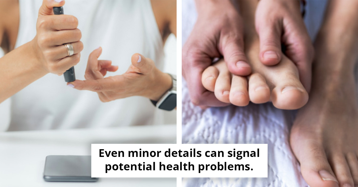 Insightful Analysis: Unveiling the Significance of Hairless Toes in Detecting Serious Health Issues