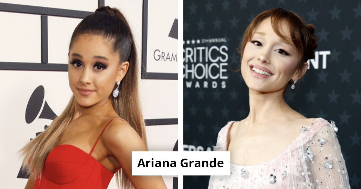 Ten Years Later These Celebrities Look Completely Different