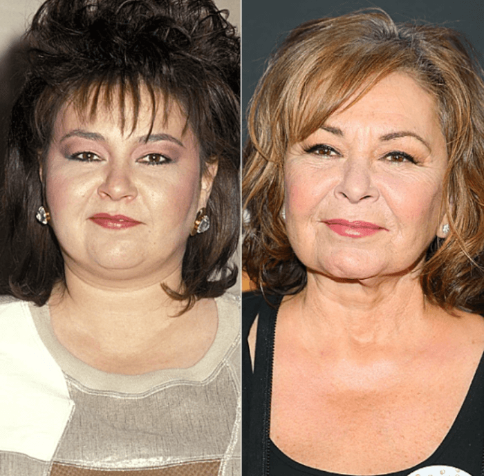 20. Roseanne Barr has undergone several procedures, but regarding her nose, she summed it up: “It was round, and my surgeon narrowed it. Isn’t it perfect?”