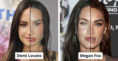 27 Red Carpet Moments That Put Hollywood's Most Controversial Cosmetic Procedure On Display