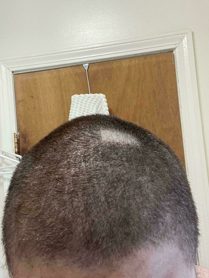 "I Forgot I Took The Guard Off To Clean It And Went To Touch Up A Spot I Noticed"