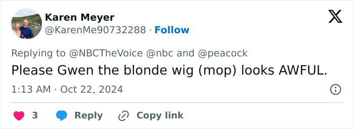 The wig is awful