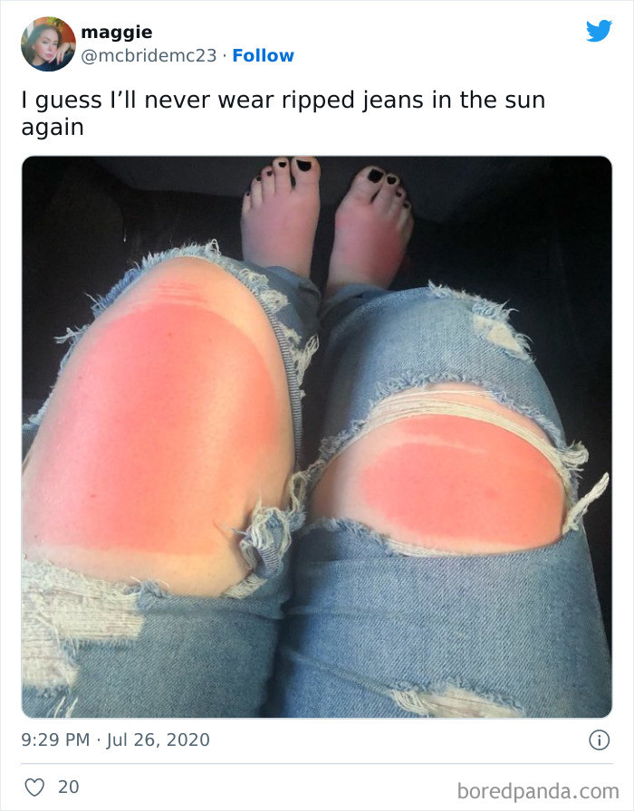 18. Ripped jeans and ripped skin.