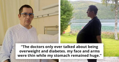 Man’s 60-Pound Tumor Misdiagnosed as Obesity Sparks Outrage—The Shocking Truth Behind His 12-Year Battle