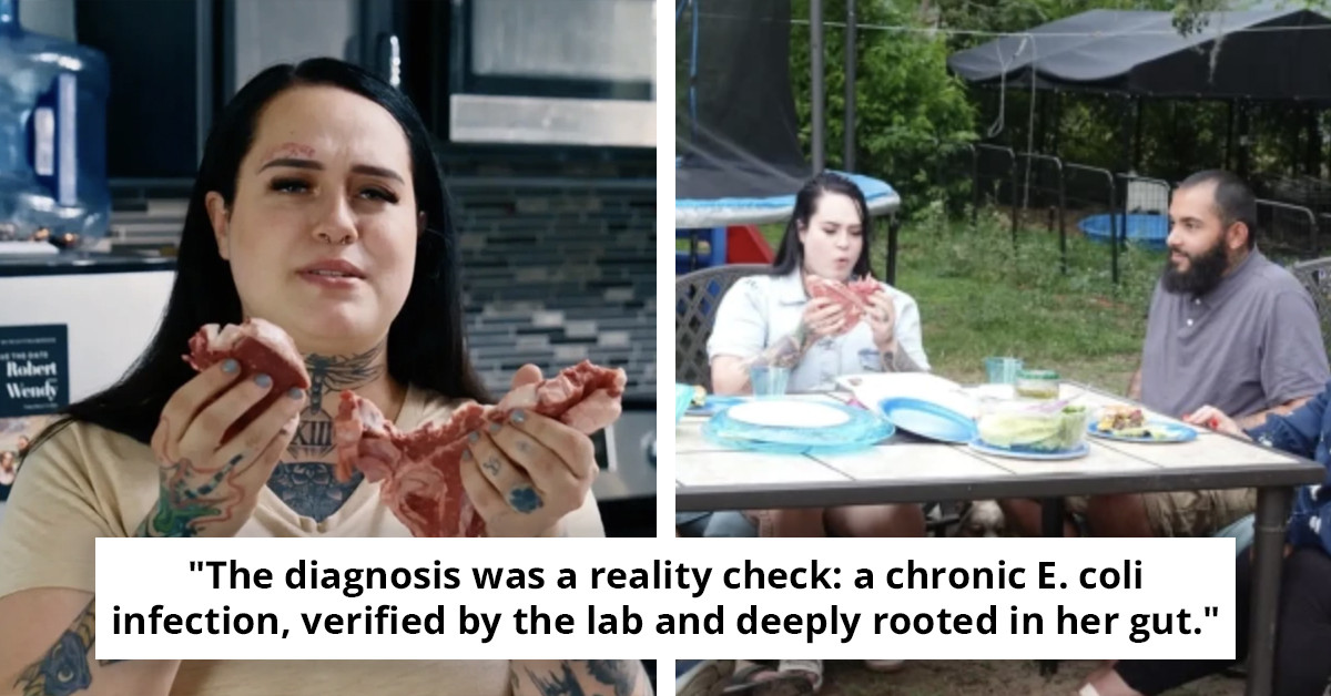 Nurse's Cautionary Tale: Woman Discloses Effects of Consuming 2lbs of Raw Meat Daily