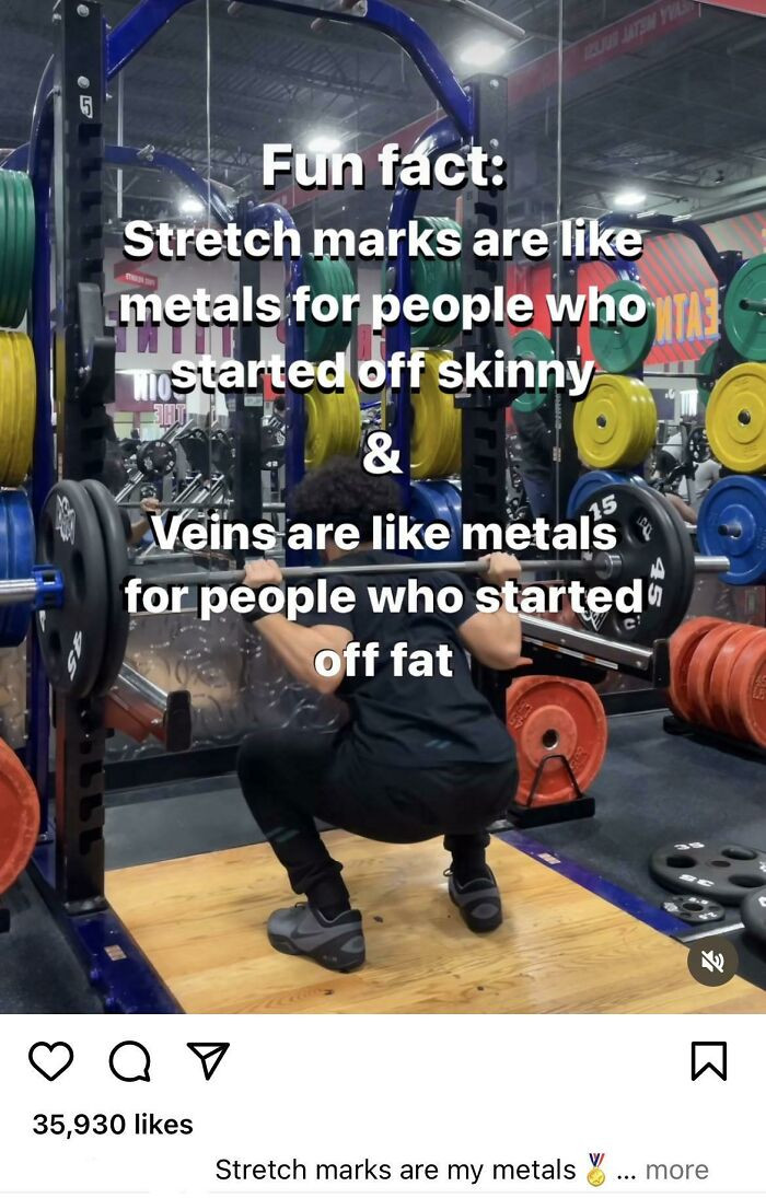 47.Stretch marks are my metals