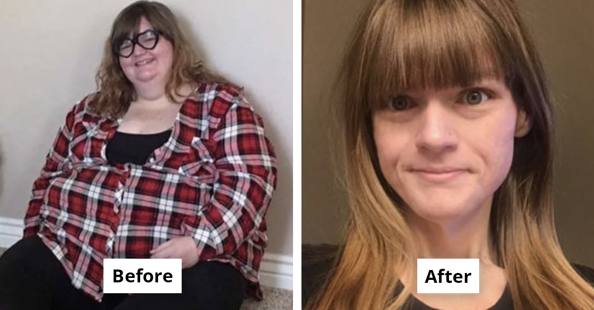 Incredible Before And After Photos That Will Leave You Speechless