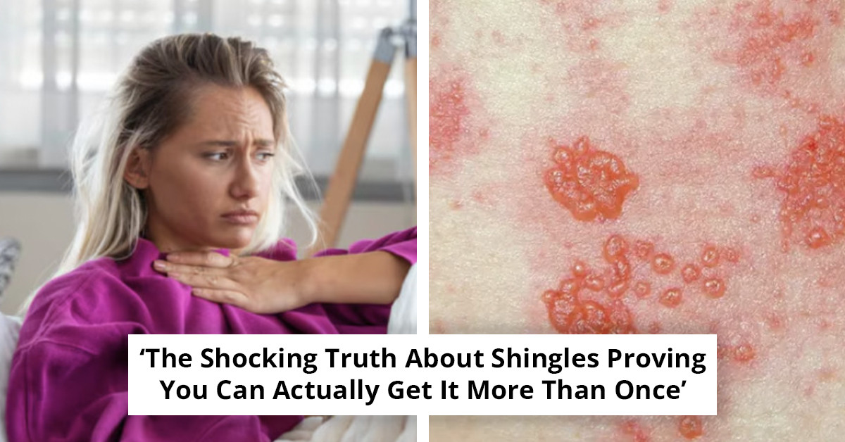 Painful Virus On The Rise Among Women In Their 30s And 40s