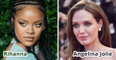 Seven Of The Best Celebrity Lips - Chosen By Top Plastic Surgeons