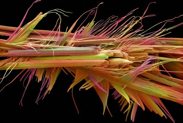"Caffeine Crystals Under A Microscope"