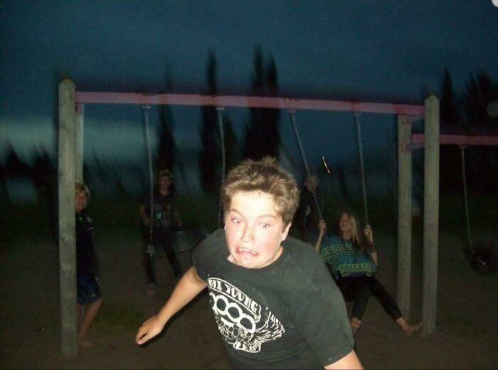 "I Was 13 And We Decided To See Who Could Jump The Farthest Off The Swing. This Was The Moment Before I Hit A Pole At The Playground"