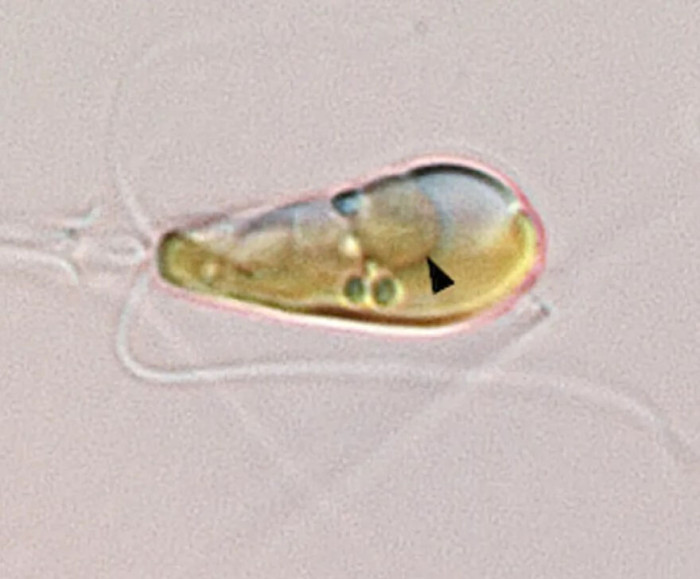 "The Once-in-an-Eon Event That Gave Earth Plants Has Happened Again; the First-Ever Nitrogen-Fixing Organelle in a Eukaryotic Cell Has Been Confirmed"