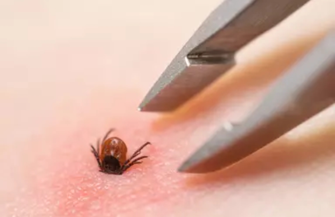 Infected ticks spread the Lyme Disease