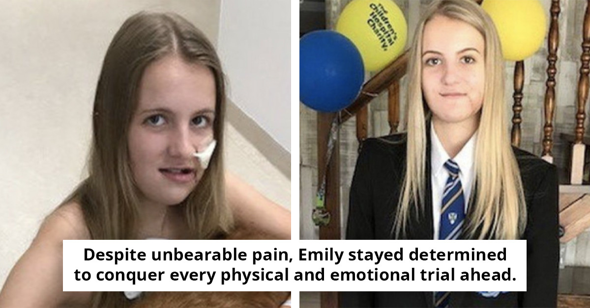 Teenager's Jaw Rebuilt After Horrific Horse Riding Accident: A Story of Resilience and Reconstruction