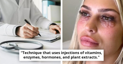 Doctors Sound The Alarm On A New Beauty Trend That Leaves People With Reptile-Looking Skin