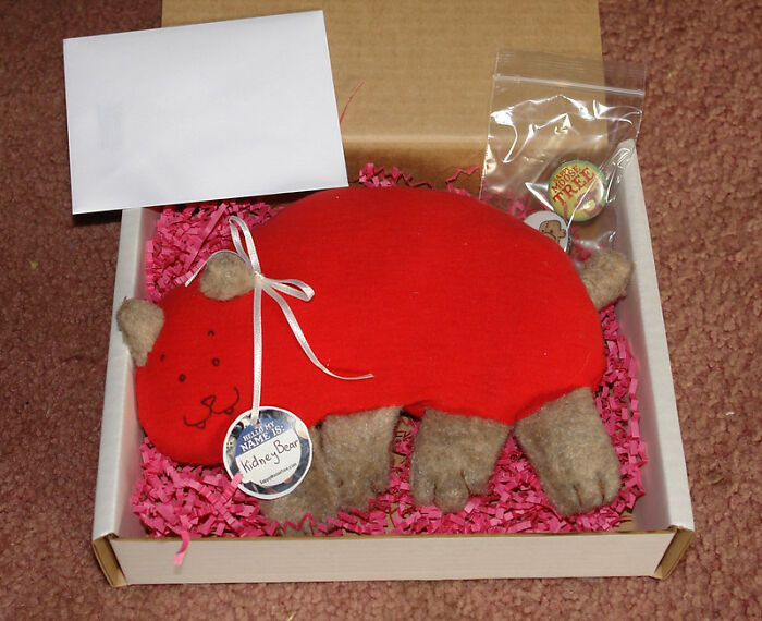 17. I guess we now know where that missing kidney went.