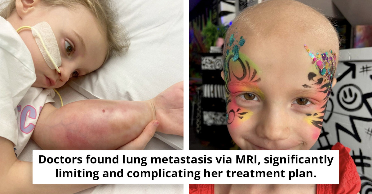Six-Year-Old Girl Faces Heartbreaking Diagnosis After 'Arm Injury' Revealed to Be Cancer