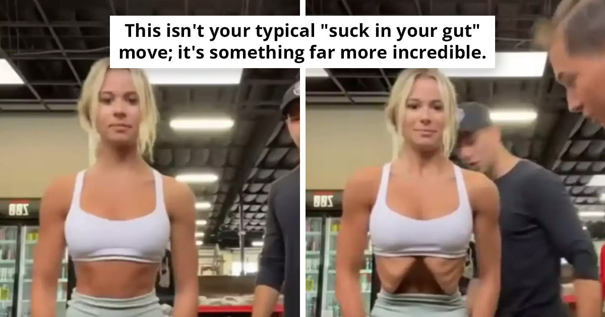 The Incredible Vanishing Act - Woman's Stomach Disappears