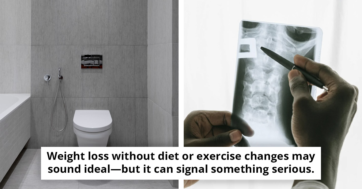 Bowel Cancer Is Rising In Gen Z And Millennials