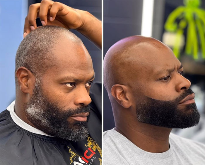 Before & After
