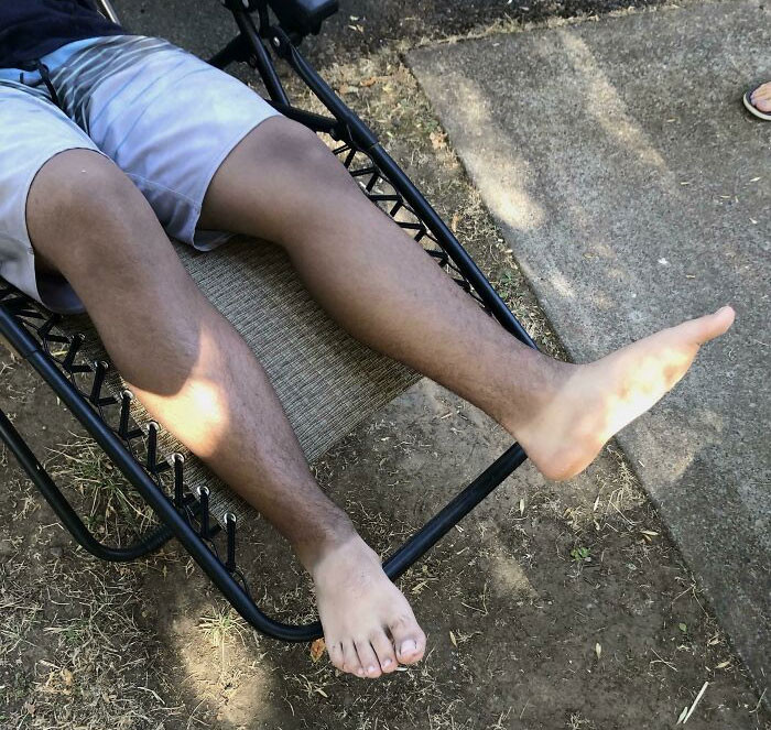 26. Probably better than wearing Crocs and having a polka dot foot.