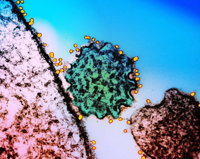 Health officials explain Nipah virus risks after death linked to raw sap consumption