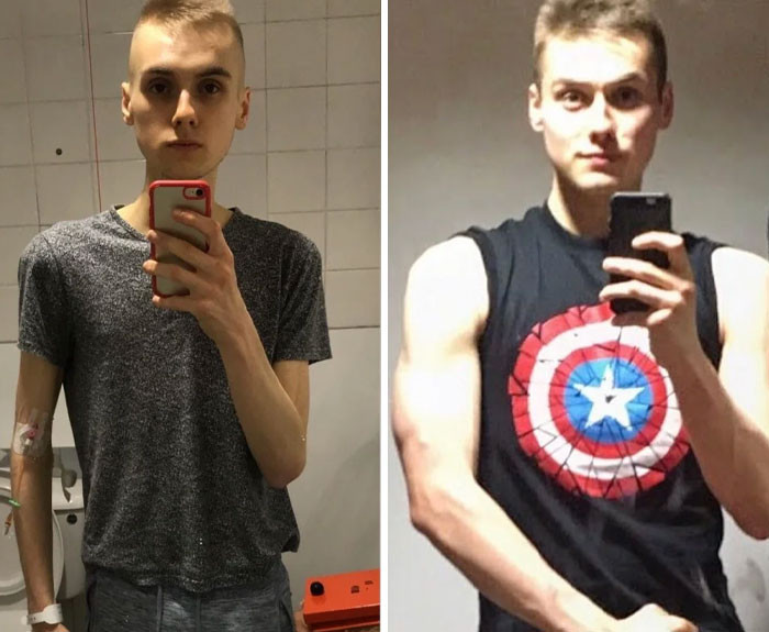 "M/22/5'11" [99lbs > 150lbs = 51lbs] Anorexia My Recovery"