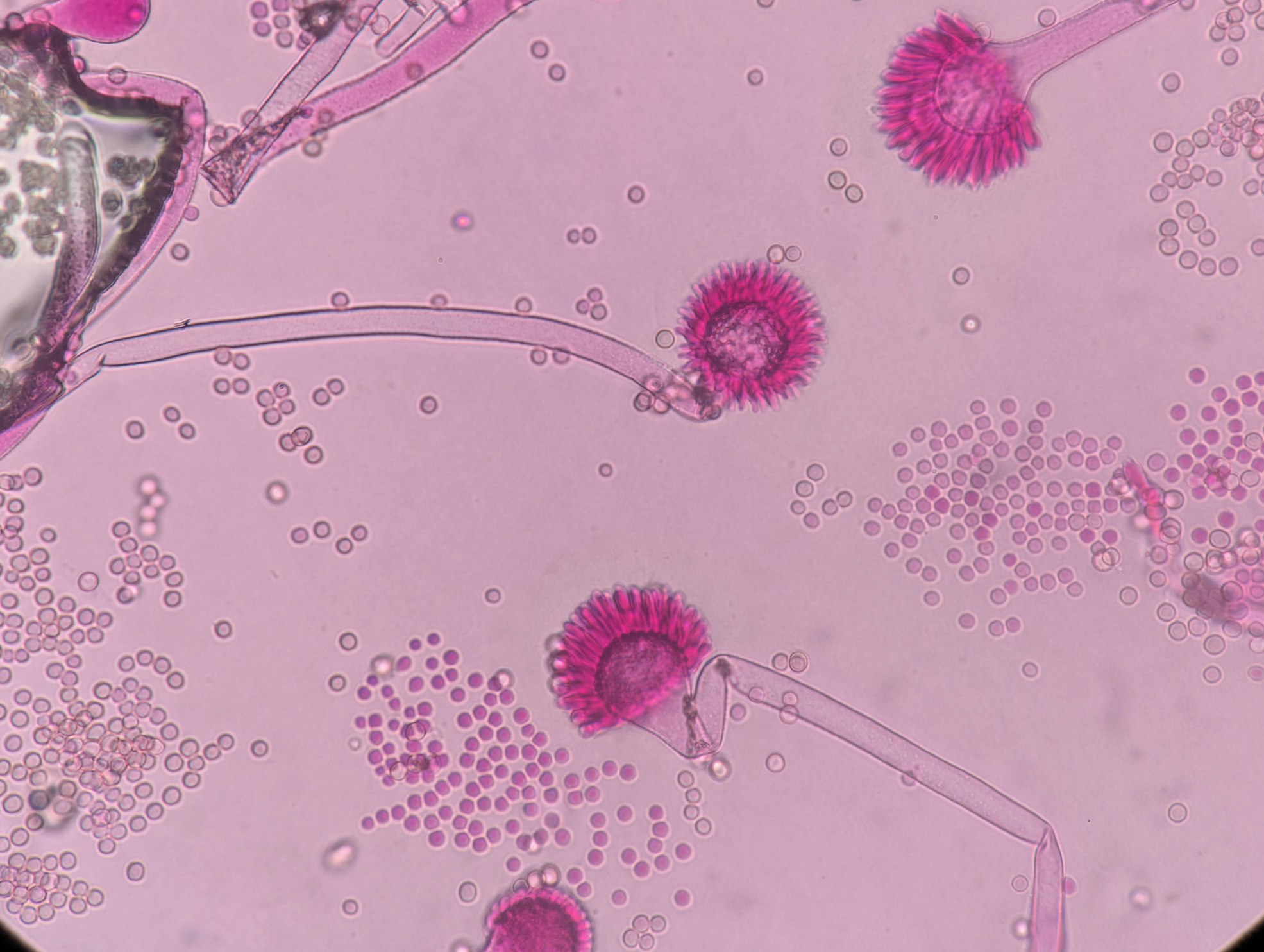 The unsettling pink slime is caused by a bacterium called Serratia marcescens.