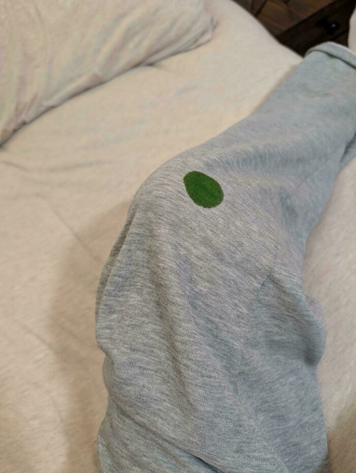 'I Woke Up And Found This Weird Dark Green Stain On My Pants. Nowhere Else, Just There'