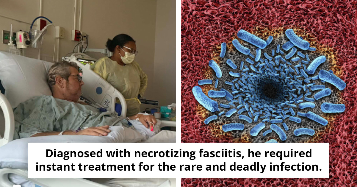 Individual Faces 10% Survival Odds After Developing Flesh-Eating Infection from Minor Scratch